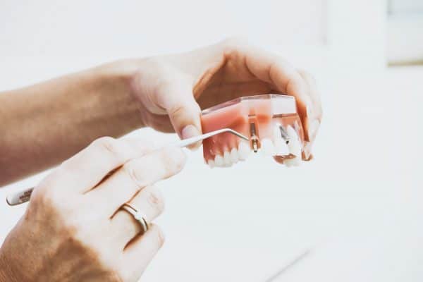 Pourquoi poser un implant dentaire en cas de mauvaise dentition ?